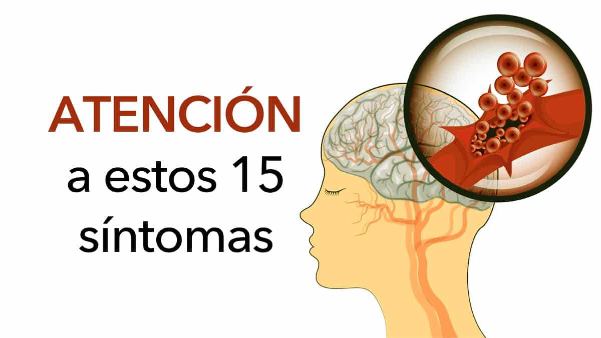 Impeça um acidente vascular cerebral: 15 sintomas de acidente vascular cerebral que nunca se deve passar por alto