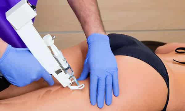 Mesoterapia para Celulite