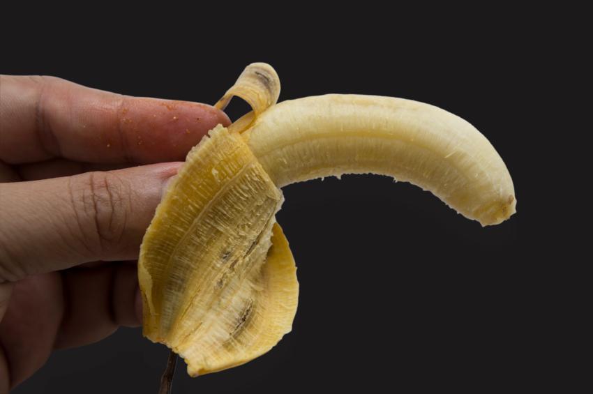 PÊNIS CURVO? Aqui estão os casos em que é possível endireitá-lo!